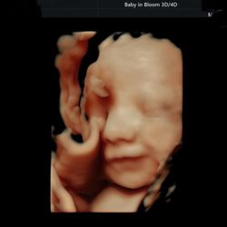 Baby in Bloom