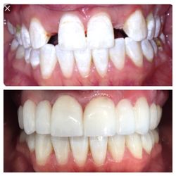 D Dental