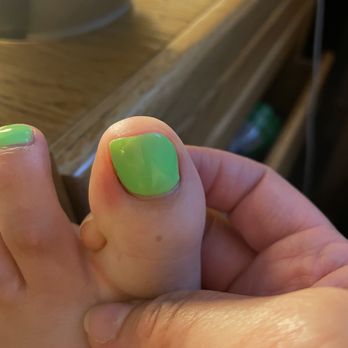 T Nails Spa - Inflamed cuticle with dried blood - Waxing Near Me - Fremont, California T Nails Spa - Inflamed cuticle with dried blood - Waxing Near Me - Fremont, California