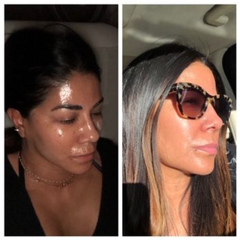 Eleven11 Laser + Skincare - Laser Hair Removal Near Me - Denver, Colorado Eleven11 Laser + Skincare - Laser Hair Removal Near Me - Denver, Colorado
