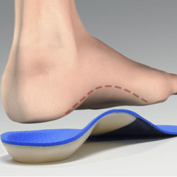 Alpine Foot & Ankle Clinic - Custom Foot Orthotics can be used to manage a variety of conditions and be used in many shoes, including heels.