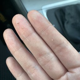 Residual product left on my face after facial