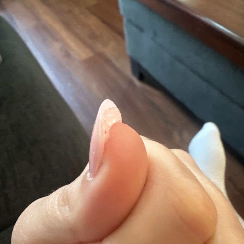 Example of gob of glue under nail Example of gob of glue under nail