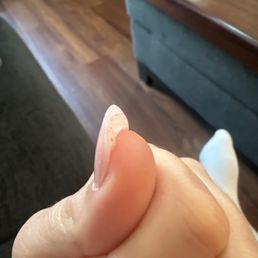 Example of gob of glue under nail