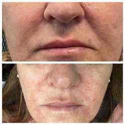 Dermatology Institute - Immediate results