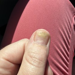 Bliss Nail Spa - This is a photo of what they did to my nail with acrylics... this is about a month grown out.