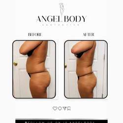 Angel Body