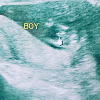 The Baby Connection 61 Photos 121 Reviews Diagnostic Imaging 2 Scripps Dr Sacramento Ca Phone Number