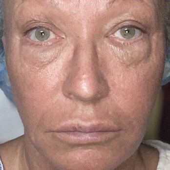 Nazih M Haddad, MD - Cosmetic Surgeons Near Me - Newport Beach, California Nazih M Haddad, MD - Cosmetic Surgeons Near Me - Newport Beach, California