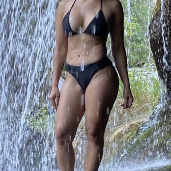 Mia Aesthetics - Picture taken last week. You can see all the flaws on my stomach that I've never had before surgery. - Plastic Surgeons Near Me - Miami, Florida Mia Aesthetics - Picture taken last week. You can see all the flaws on my stomach that I've never had before surgery. - Plastic Surgeons Near Me - Miami, Florida
