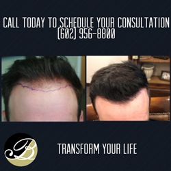 Scott Alexander, MD - Biltmore Surgical Hair Restoration