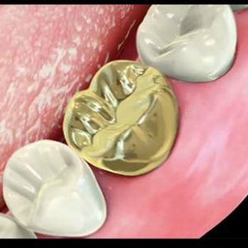 Crossroads Dental - untitled - Cosmetic Dentists Near Me - Grand Junction, Colorado