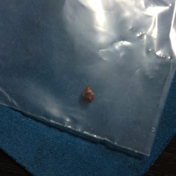 Bronstein Properties - One of many Bed bugs courtesy of Bronstein properties - Real Estate Services Near Me - Forest Hills, New York