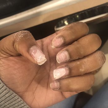 Famous Nails - Nail beds ruined. - Massage Near Me - Savannah, Georgia