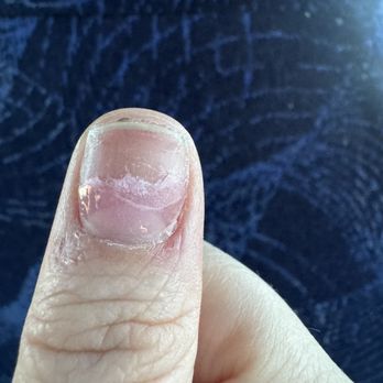 Vernon Nail - Nail broke within 28 hours. Tip was not fully glued on. - Nail Salons Near Me - Roseville, California Vernon Nail - Nail broke within 28 hours. Tip was not fully glued on. - Nail Salons Near Me - Roseville, California