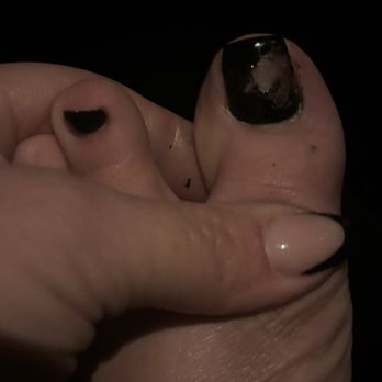 Lux Nails Lounge 1 - How my toes have been 1 day after my services - Nail Salons Near Me - Gilbert, Arizona Lux Nails Lounge 1 - How my toes have been 1 day after my services - Nail Salons Near Me - Gilbert, Arizona