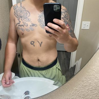 Ink Me Aesthetics - Today- still in progress - Body Contouring Near Me - Sacramento, California