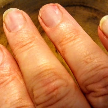 North Hollywood Nails - Nail ripped off while removing acrylics. - Nail Salons Near Me - Los Angeles, California North Hollywood Nails - Nail ripped off while removing acrylics. - Nail Salons Near Me - Los Angeles, California
