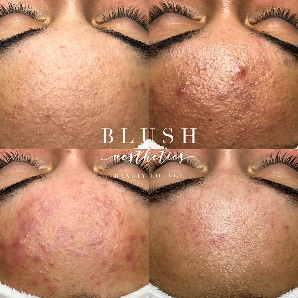 Blush Aesthetics Beauty Lounge Logo