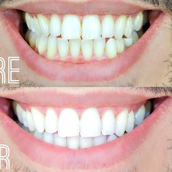 Red Square Dental & Orthodontics - Professional Teeth cleaning and teeth whitening recommend x1000000