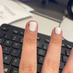 Fashion Nail - Day 2 of where she ripped skin off. Very painful