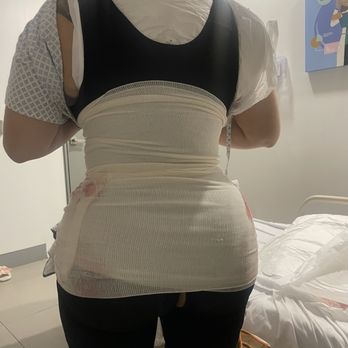 EMBELLECETE - This is an example of course I am still swollen since I just got off surgery. - Cosmetic Surgeons Near Me - Aguacaliente, California