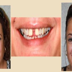 Avant Dental Group