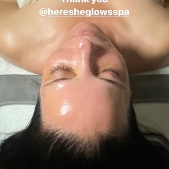 Here She Glows Spa - After the fire and ice facial! - Day Spas Near Me - Agoura Hills, California