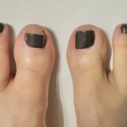 Elysian Nails - Both feet to compare big toes.