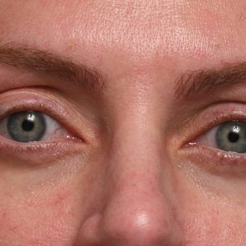 Kenneth D Steinsapir, MD - Cosmetic Surgeons Near Me - Beverly Hills, California