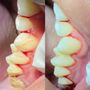 Photo of Insta Smile Dental Clinic