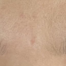 My eyebrows after she thread them My eyebrows after she thread them