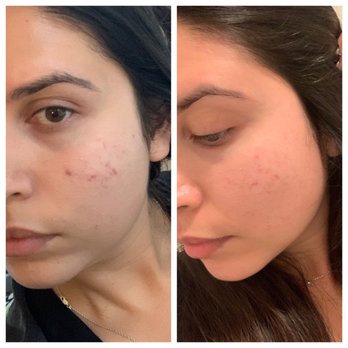 Facialworks - Skin Care Near Me - Irvine, California