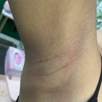 Skin Palace OC Salon - Underarm sugaring by Emily - Skin Care Near Me - Tustin, California Skin Palace OC Salon - Underarm sugaring by Emily - Skin Care Near Me - Tustin, California
