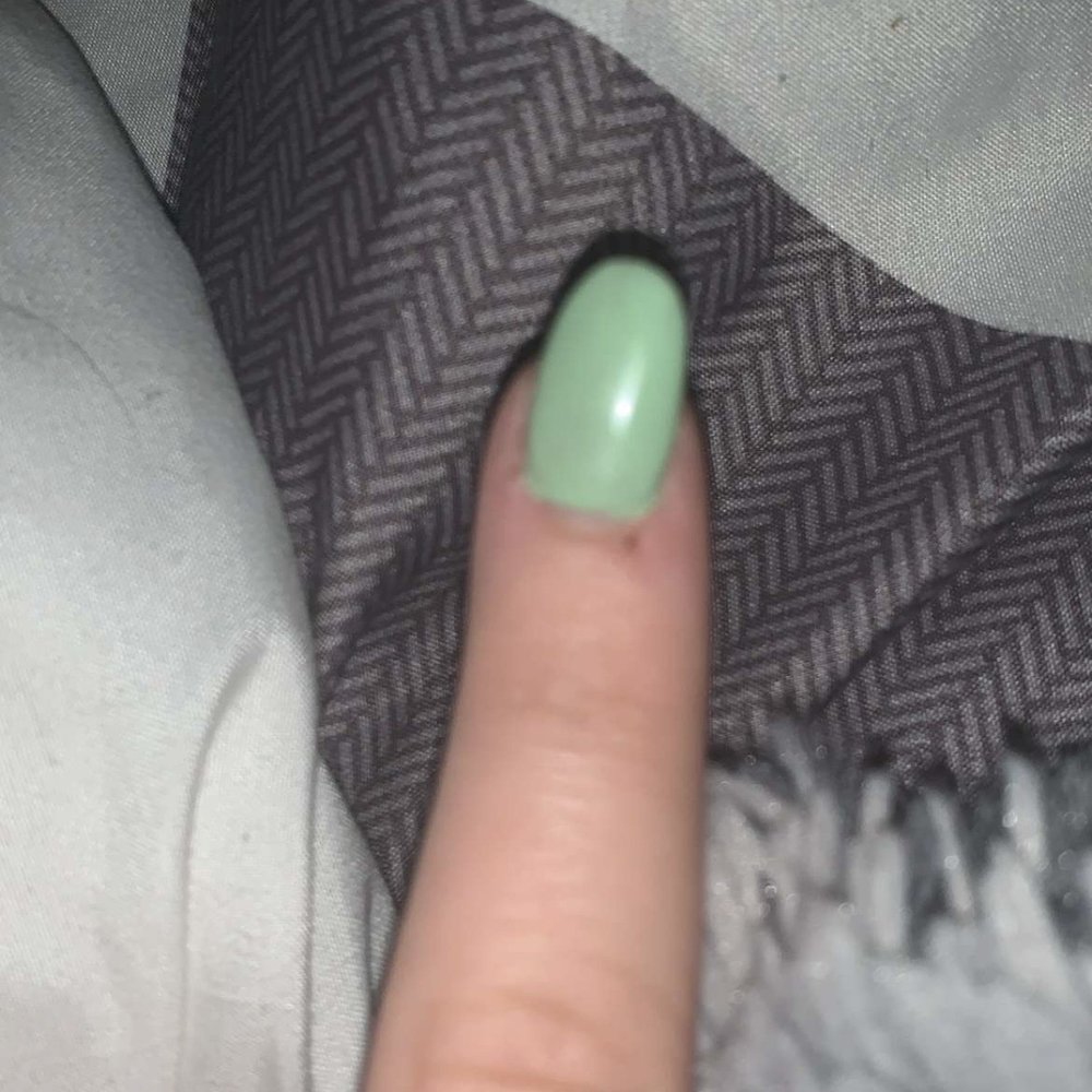 Crooked nail