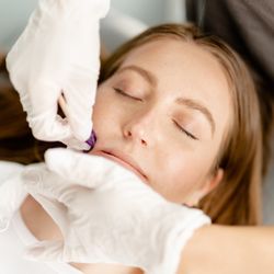 WAXON Laser + Waxbar - Toronto Bloor West Village