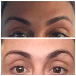 Bottom before top after:) Bottom before top after:)