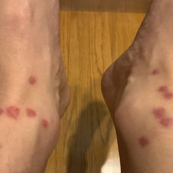 Drury Inn & Suites Sikeston - BEDBUGS ARE FUN! - Hotels Near Me - Miner, Missouri