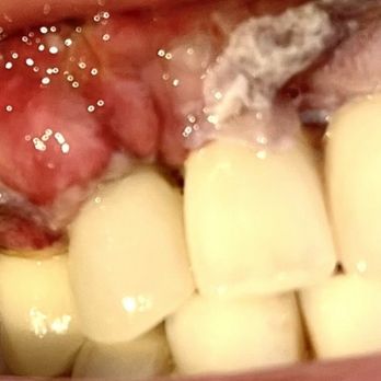 Alfred Penhaskashi, DDS - My gums!!!!! - Periodontists Near Me - Encino, California Alfred Penhaskashi, DDS - My gums!!!!! - Periodontists Near Me - Encino, California