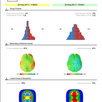 Whole Brain Power - WPB's Heart Rate Variability scan's also show your Brain health and shares the factors that are causing that current condition. - Life Coach Near Me - Tustin, California Whole Brain Power - WPB's Heart Rate Variability scan's also show your Brain health and shares the factors that are causing that current condition. - Life Coach Near Me - Tustin, California