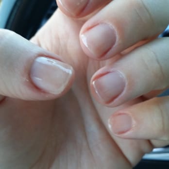 Lena's Nails - Post gel polish removal with a NailTek treatment. - Nail Salons Near Me - Castro Valley, California Lena's Nails - Post gel polish removal with a NailTek treatment. - Nail Salons Near Me - Castro Valley, California