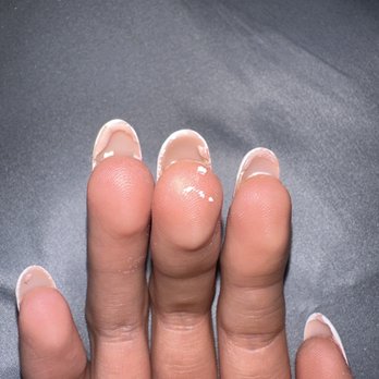 # 1 Nail And Spa - How the back of my hand looks... so horrible!. - Nail Salons Near Me - Fontana, California
