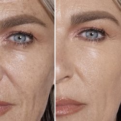 Perfect Brows By Pawan - Eyebrow Threading. before and after