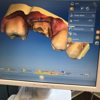 The Toothery - 3D image of the teeth. - General Dentistry Near Me - Hoffman Estates, Illinois The Toothery - 3D image of the teeth. - General Dentistry Near Me - Hoffman Estates, Illinois