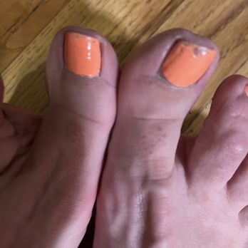 Clark Nails - Bad pedicure - Nail Salons Near Me - Clark, New Jersey