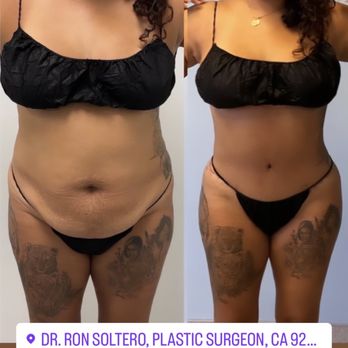 Ron Soltero, Plastic Surgeon - Bidy - Cosmetic Surgeons Near Me - San Diego, California Ron Soltero, Plastic Surgeon - Bidy - Cosmetic Surgeons Near Me - San Diego, California
