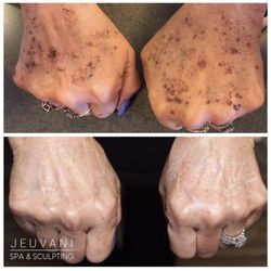 Jeuvani Spa and Sculpting