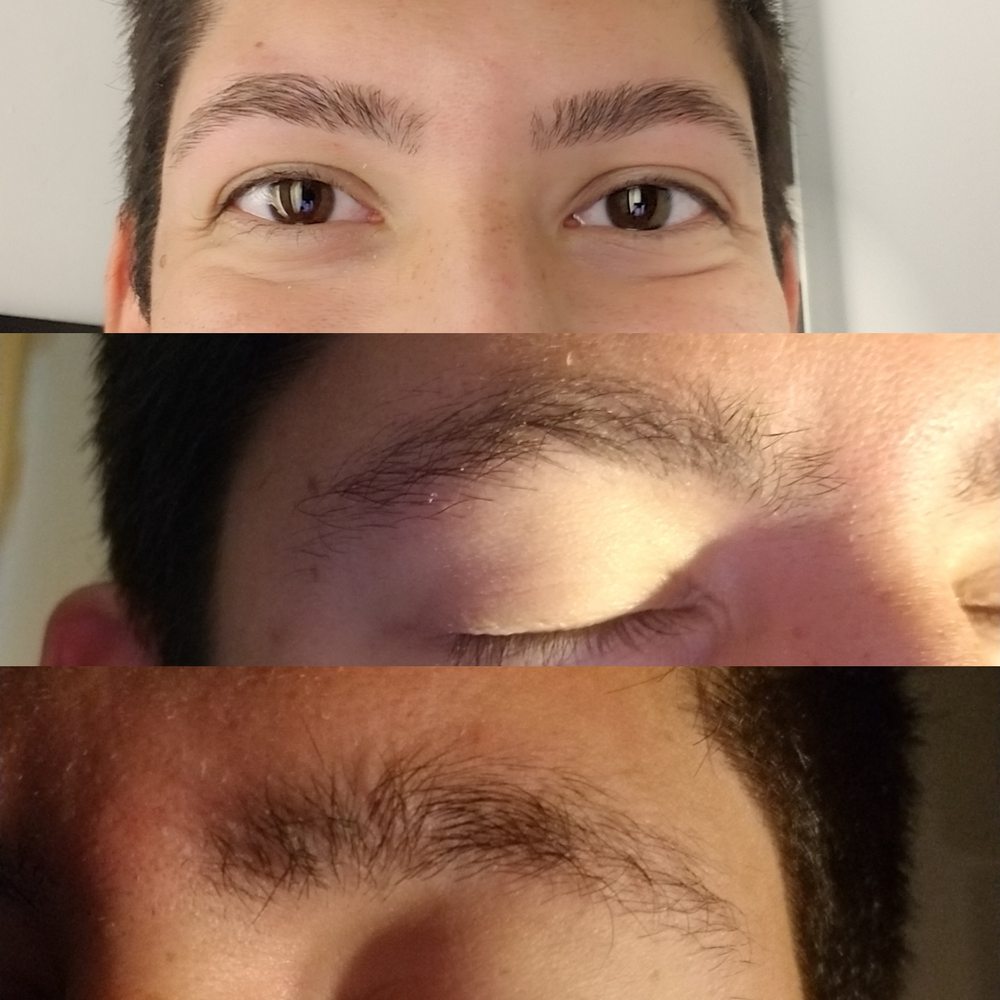 After is the top photo. Before are the two photos below that.
