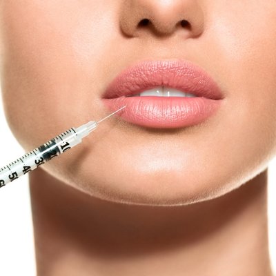 Filler Injections - Dermal Fillers diminish facial lines and restore volume and fullness in the face Filler Injections - Dermal Fillers diminish facial lines and restore volume and fullness in the face