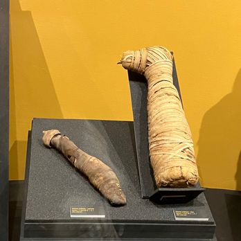 Musée de la médecine - Mummified human remains. - Landmarks & Historical Buildings Near Me - Anderlecht, BRU